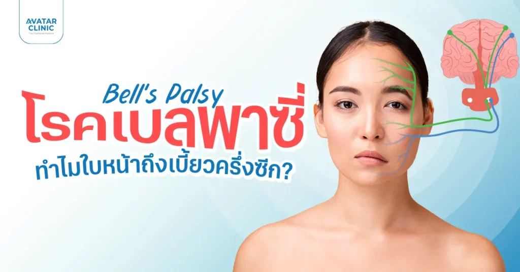 โรคเบลพาซี่เกิดจากอะไร ป้องกันได้หรือไม่ ?