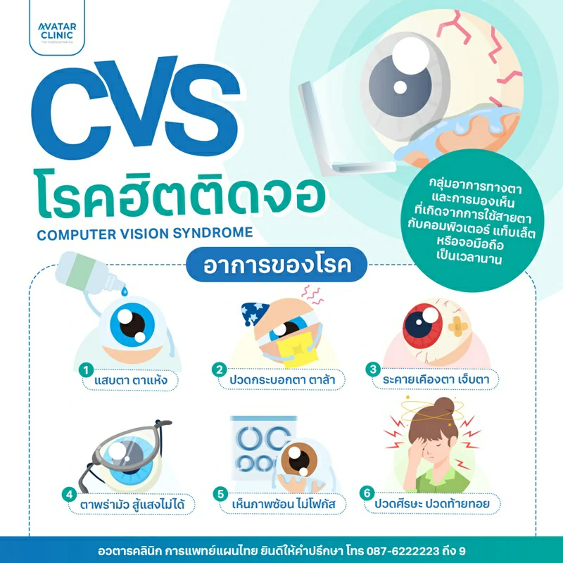 CVS โรคฮิตติดจอ