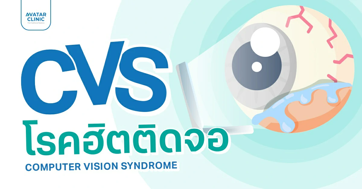 CVS โรคฮิตติดจอ